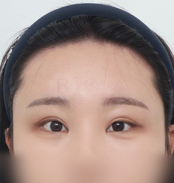 [이마거상축소] 후