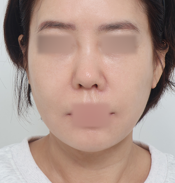 [하안면 미니거상] 후