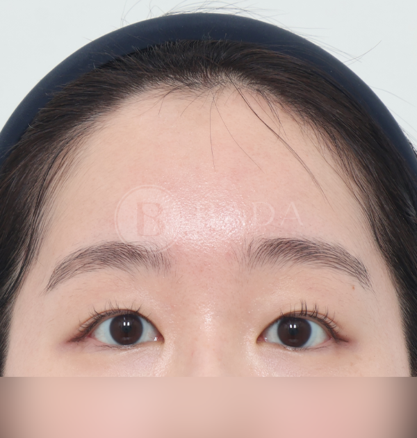 [이마거상] 후