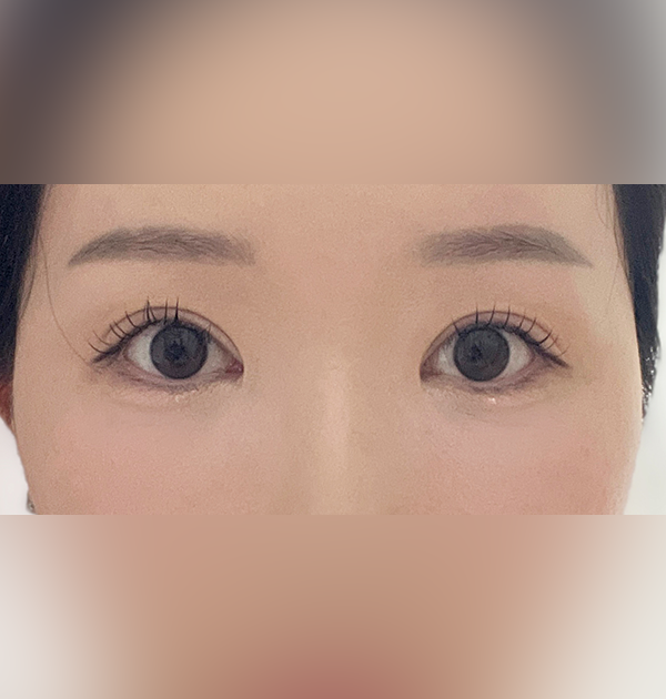 [이마거상] 후