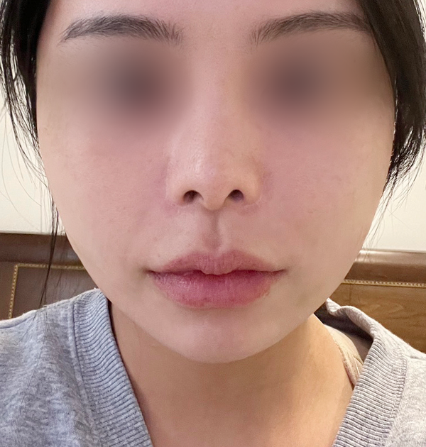 [중안면 미니거상] 후