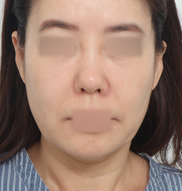 [하안면 미니거상] 전