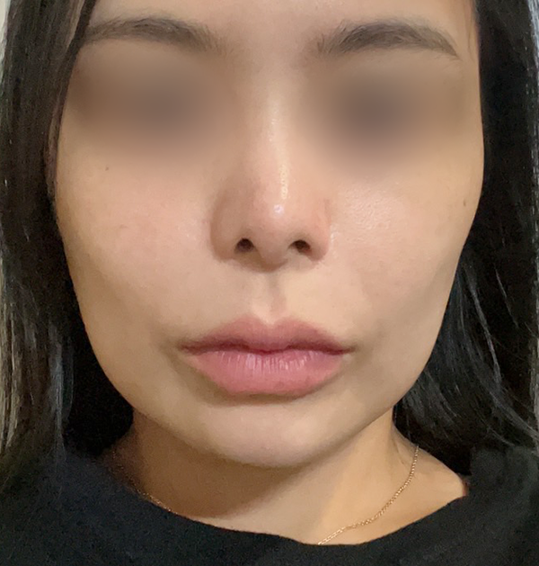 [중안면 미니거상] 전
