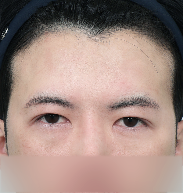 [남자 이마거상] 전