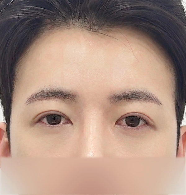 [남자 이마거상] 후
