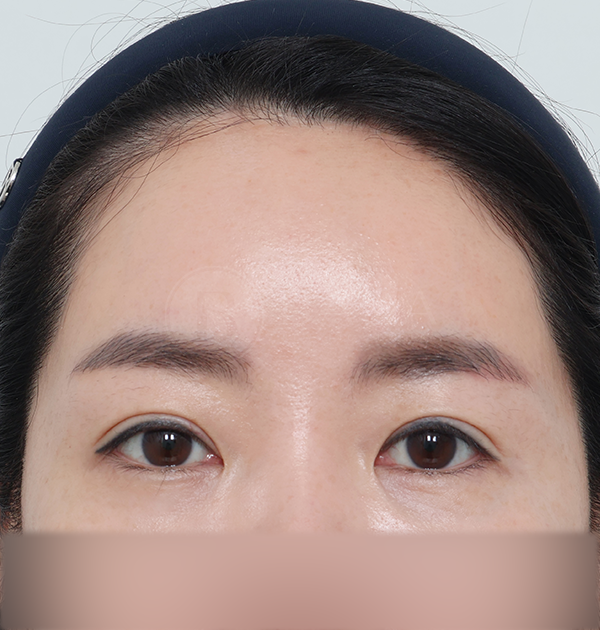 [이마거상] 후
