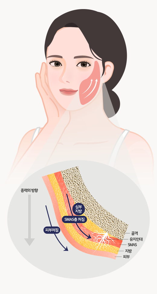 효과