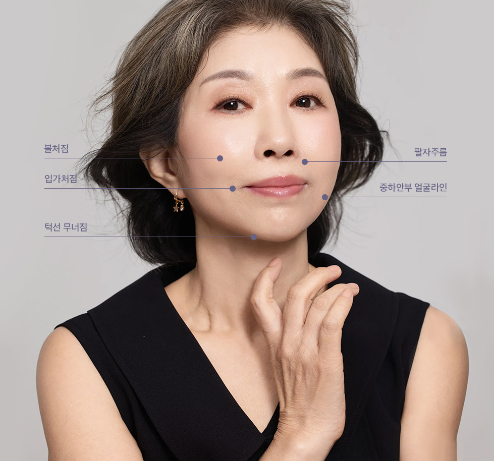 안면거상술 수술정보