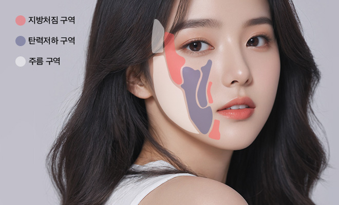 리프팅과 볼륨까지 함께 고려한 <br>3D 맞춤 디자인