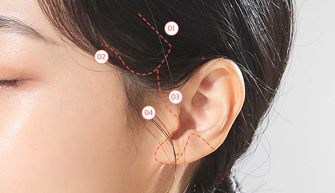 환자 특성에 맞는 커스텀 리프팅