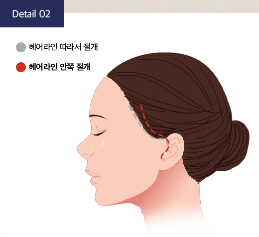 효과