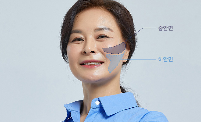 중안면과 하안면부 동시 개선 효과