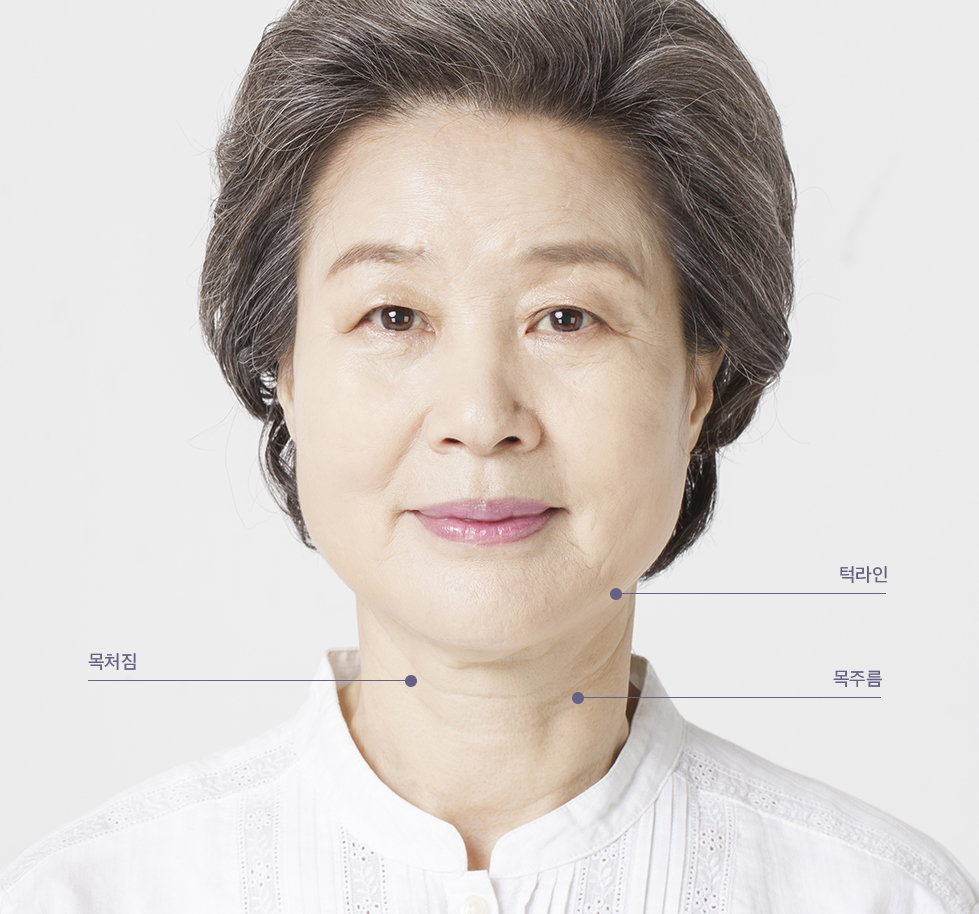 중하안면 미니거상 수술정보