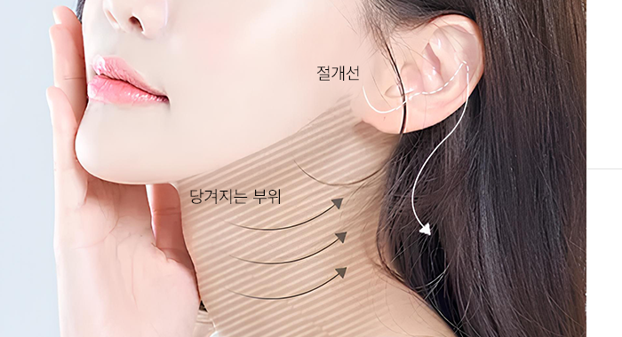리프팅 부위 설명 이미지