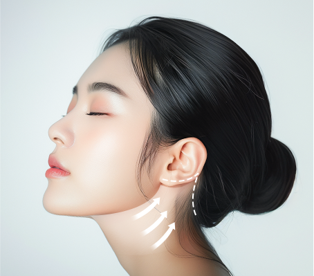 이마거상+축소술 STEP 2 이미지