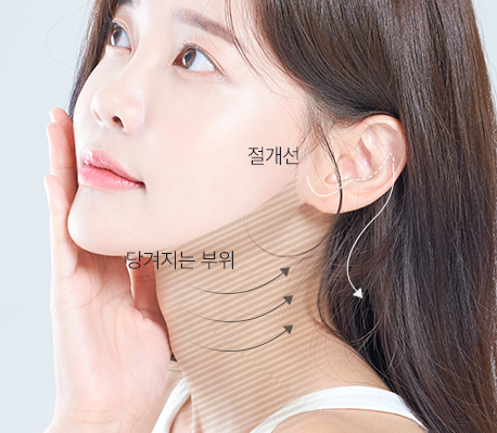 목 리프팅 이미지