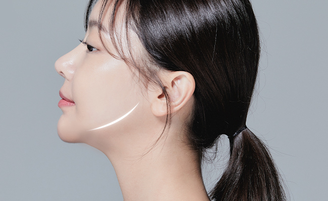 얼굴지방재배치 STEP 1 이미지