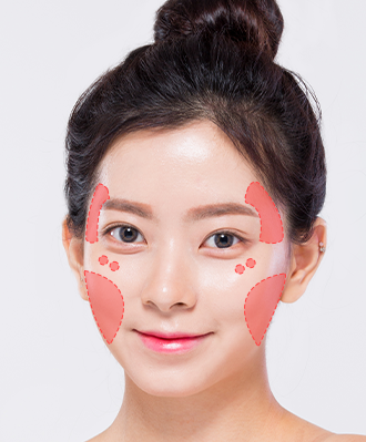 리프팅필러 STEP 1 이미지