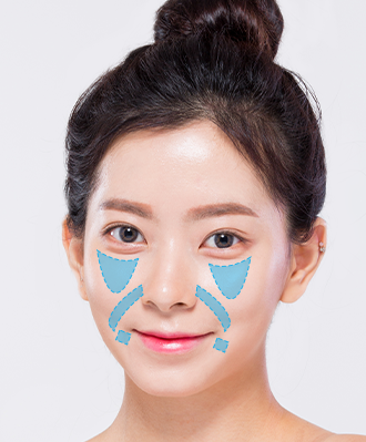리프팅필러 STEP 2 이미지