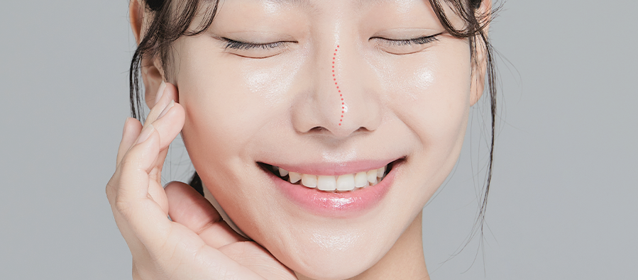 콧대가 휘어보이는 경우 이미지