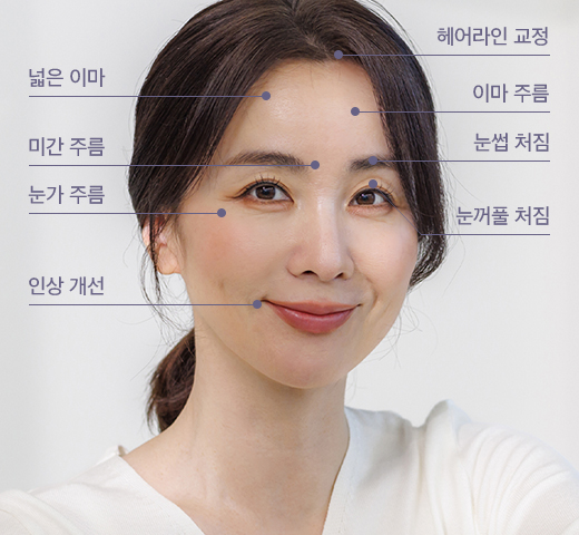 이마거상+축소술 수술정보