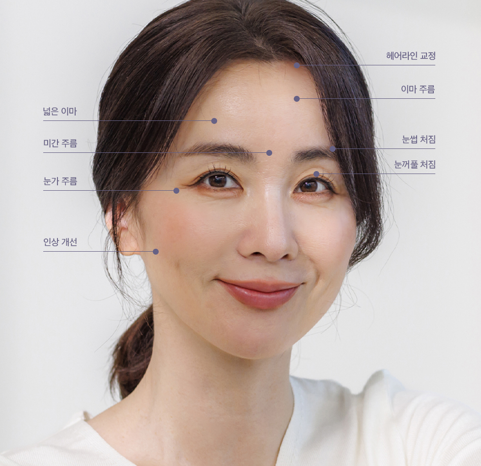 중하안면 미니거상 수술정보