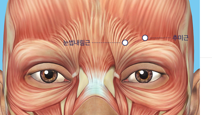 추미근과 눈썹 내림근 예시 이미지