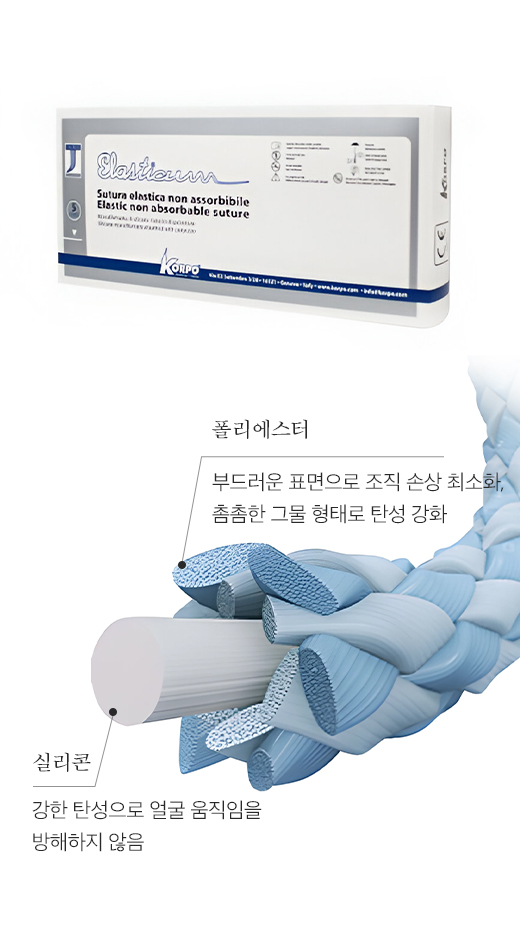 더 넓은 범위를 효과적으로 고정하는 바다만의 기술