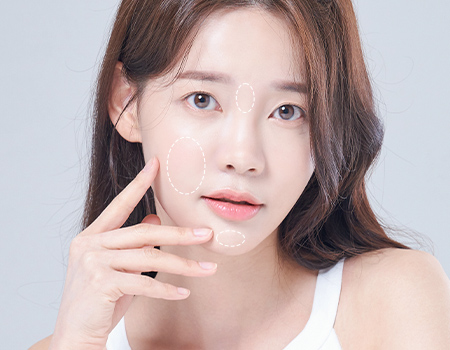 얼굴지방재배치 STEP 1 이미지